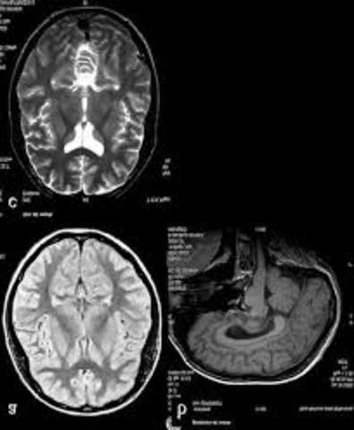 Resonancia magnética