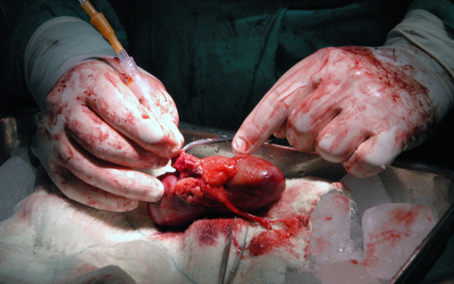 JOSEPH EDWARD MURRAY