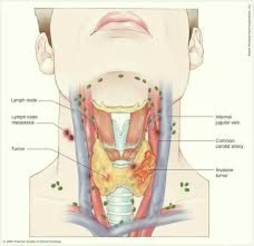¿Qué organizaciones nerviosas existen en la naturaleza?