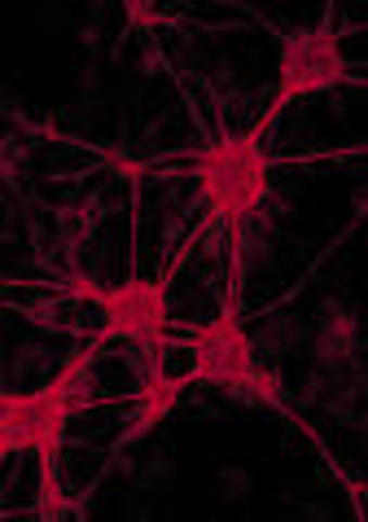 Organizaciones Nerviosas - Redes Neuronales