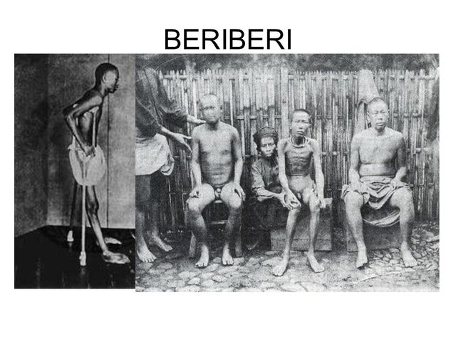 La mortalidad por beriberi en Japón había pasado a 4.000