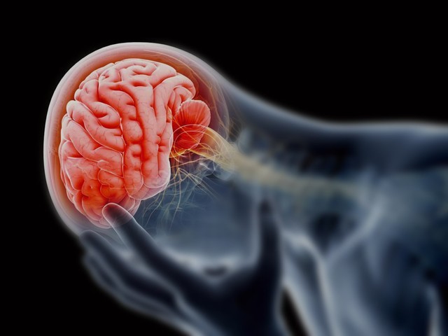 Infarto en divisoria de aguas