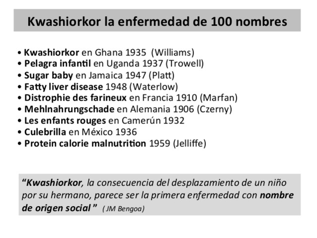 Oropesa y Castillo  titulaban al Kwashiorkor en Venezuela  Sindrome de carencia; avitaminosis
