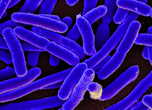 Primera observación de E.coli