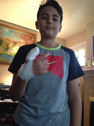 I broke Adam's thumb