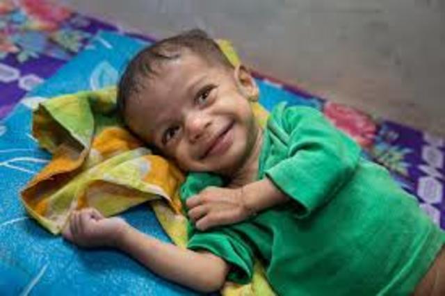 Muertes en menores de 5 años