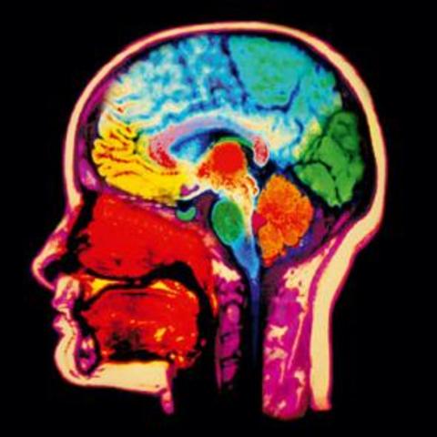 Neuroimágenes (2004)