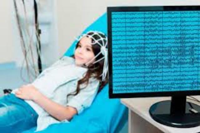 ELECTROENCEFALOGRAMA (EEG)