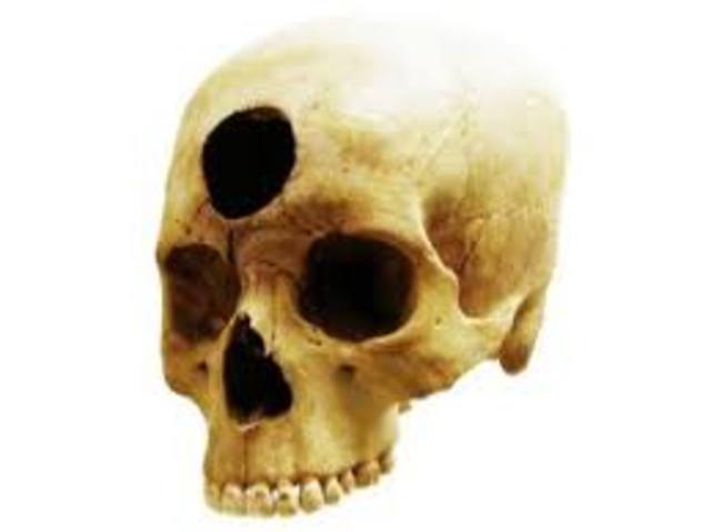 Trepanación de cráneos para liberar espíritus malignos