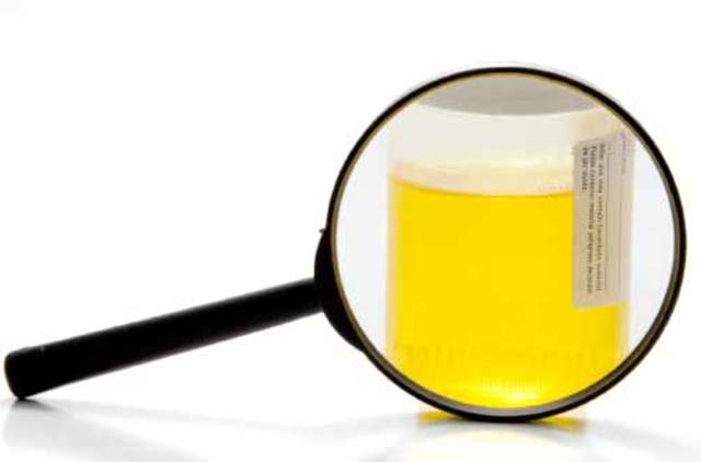 Método de fermentación