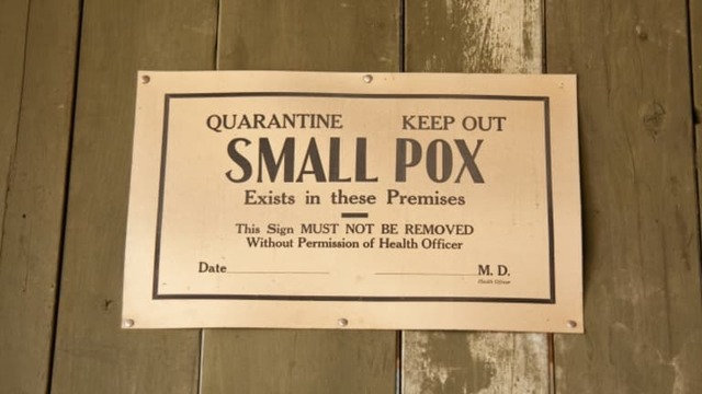 Smallpox