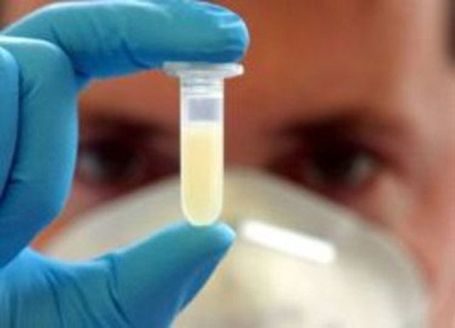 Se descubre el virus del SIDA.