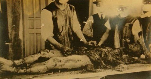 Vivisections, X-Ray Exposure, and more.