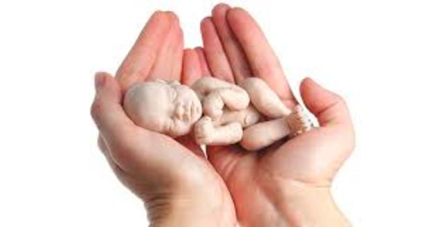 Abort with legal protection