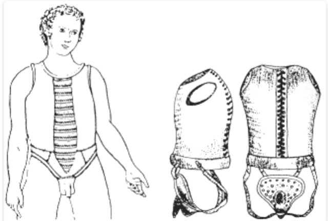 Extreme mesures for avoid kids touching themselves