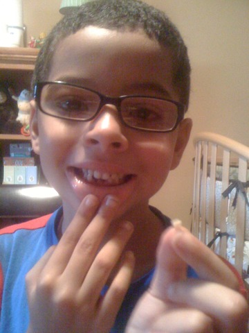 Lost My First Tooth