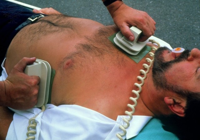 DEFIBRILLATOR