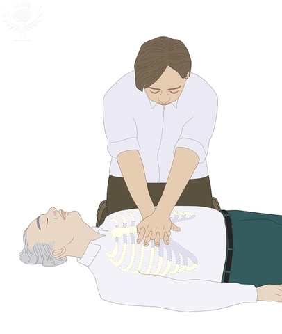 cardiopulmonary resuscitation-CPR