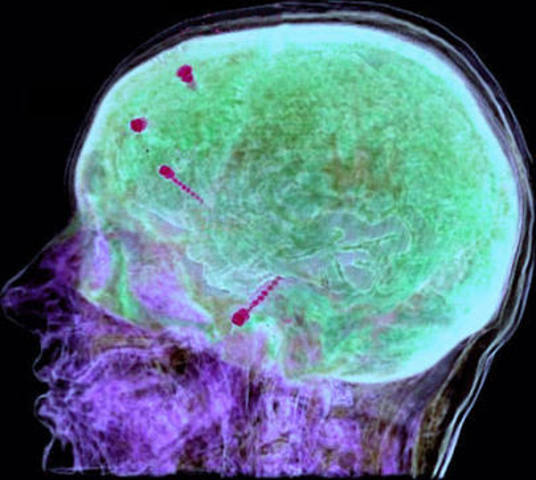 Lo mismo que el pasado