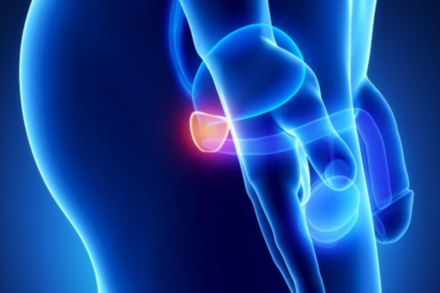 Discloses he is Diagnosed with Prostate Cancer