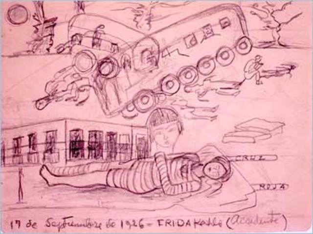 FRIDA'S ACCIDENT at age 18 - Devastating accident that plagued her throughout her life/