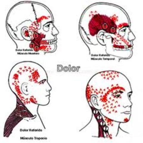 Irradiación, intermitencia, intensidad