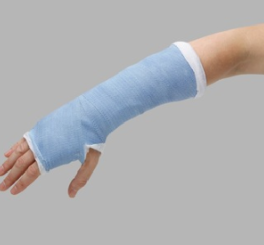 I broke my wrist