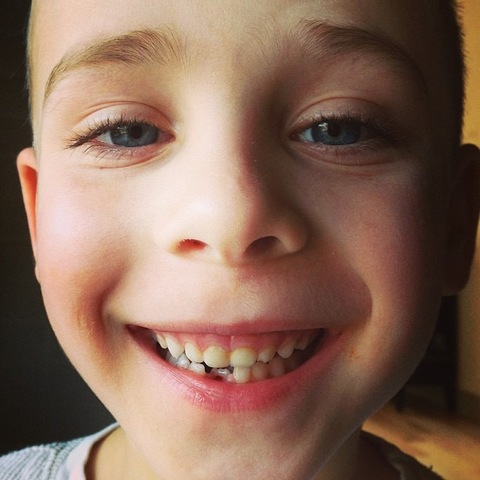 loosing my first tooth