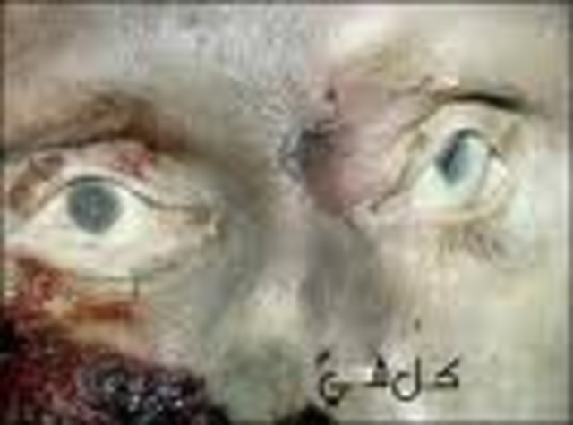 Alot of people died of nam rot.