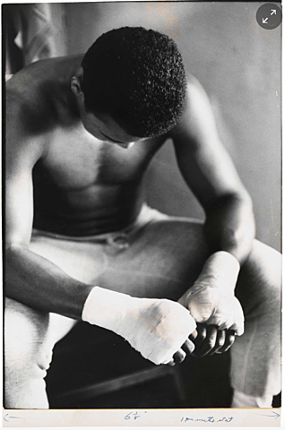 Bandaged Hands, Muhammad Ali