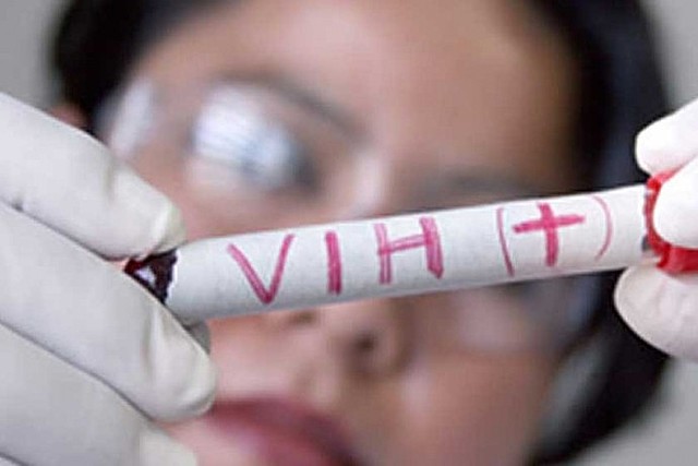 Identificación del VIH