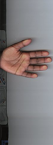 Nicki Gets Shot In The Hand