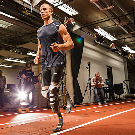 BIONIC PROSTHETICS