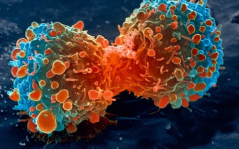 Immunotherapy for Cancer
