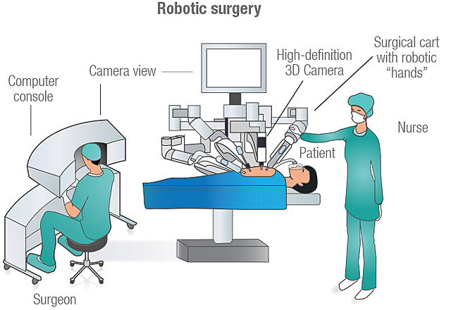 Robotic Surgery