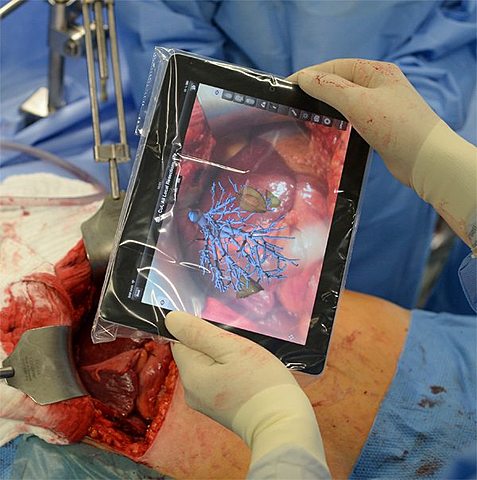 Augmented reality in medicine