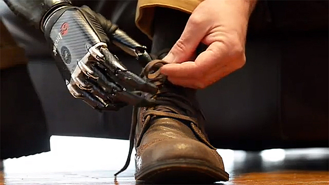 Bionic Prosthetics