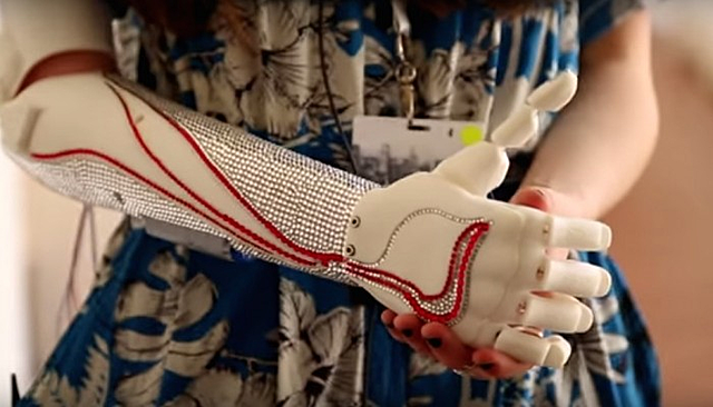 Bionic prosthetic
