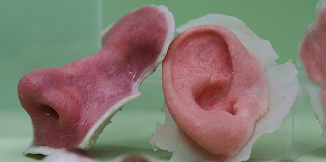 3D printed body part