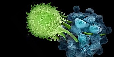 Immunotherapy for Cancer Treatment