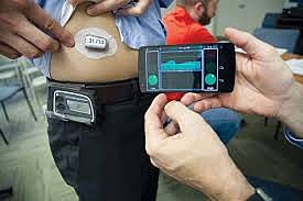 Artificial Pancreas (APS)