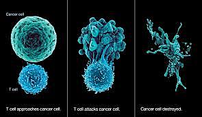 Immunotherapy fro Cancer Treatment