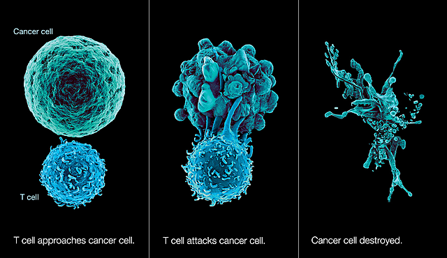 Immunotherapy for Cancer Treatment