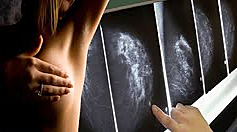 Preservando Tú Vida. Hazte tu autoexamen de mamas a tiempo.