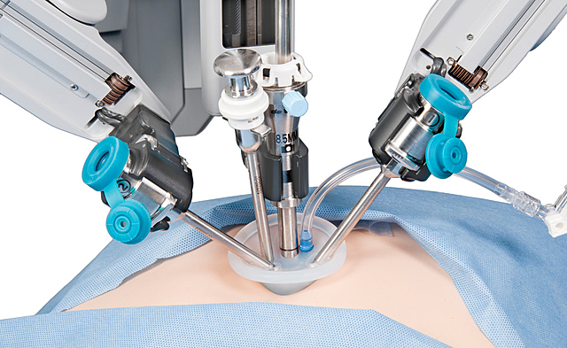 Robotic Surgery
