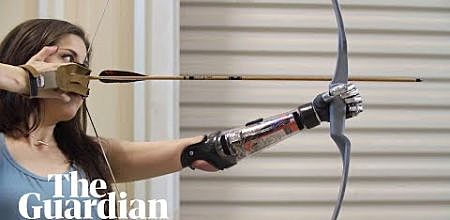Bionic Prosthetic