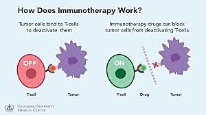 Immunotherapy for Cancer