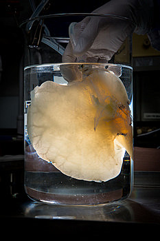 Artificial Liver