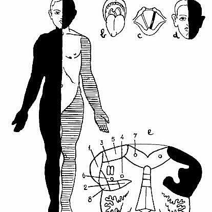 Examen físico en HUN