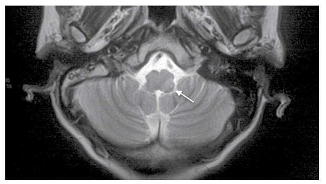 Exámenes paraclínicos